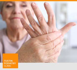 Arthritis Treatment Near Me in Tustin, CA