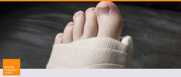 Foot Injury Clinic Near Me in Tustin CA