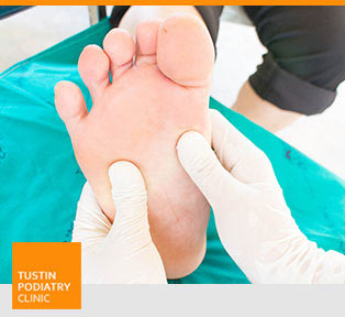 Charcot Foot - Tustin Podiatry Clinic in Tustin, CA.