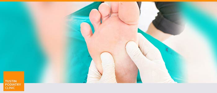 Charcot Foot Treatment Near Me in Tustin CA