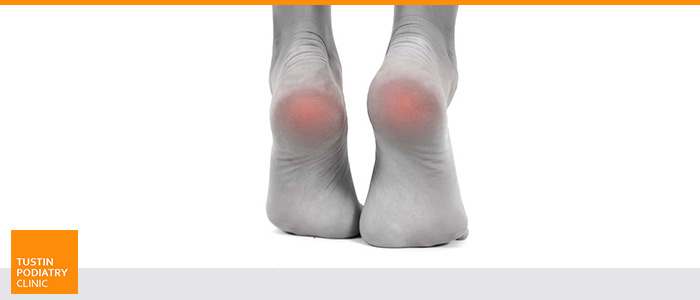 Diabetic Foot Care Near Me in Tustin CA Diabetic Foot Care Near Me in Tustin CA