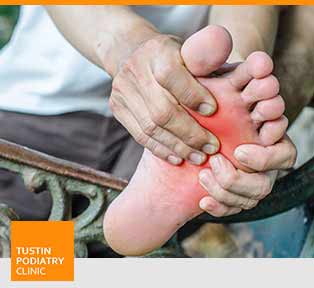 Diabetic Foot - Tustin Podiatry Clinic in Tustin, CA.