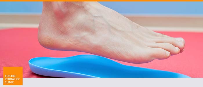 Flat Feet Treatment Specialist Near Me in Tustin CA