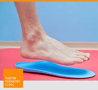 Flat Feet - Tustin Podiatry Clinic in Tustin, CA.