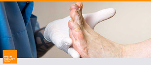 Foot and Ankle Surgery Specialist Near Me in Tustin CA