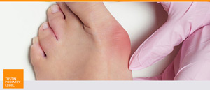 Foot Deformity Treatment Near Me in Tustin CA