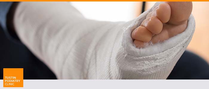 Fracture Treatment Clinic Near Me in Tustin CA Fracture Treatment Clinic Near Me in Tustin CA