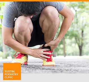 Gout - Tustin Podiatry Clinic in Tustin, CA.