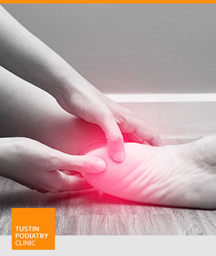 Heel Pain Treatment Near Me in Tustin, CA