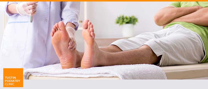 Ingrown Toenail Treatment Near Me in Tustin CA Ingrown Toenail Treatment Near Me in Tustin CA