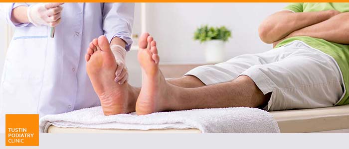 Ingrown Toenail Treatment Near Me in Tustin CA 