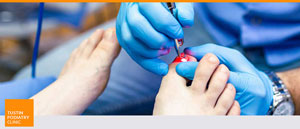 Laser Fungal Treatment Cost for Toenail Near Me in Tustin CA