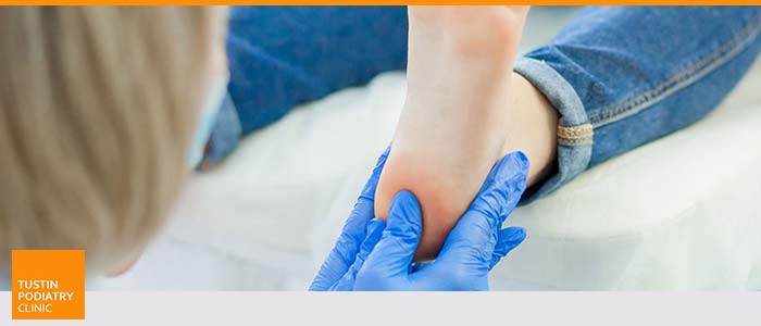 Podiatrist Near Santa Ana, CA