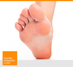 Sesamoiditis - Tustin Podiatry Clinic in Tustin, CA.