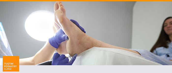 Affordable Podiatrist Accepting New Patients Near Me in Tustin CA