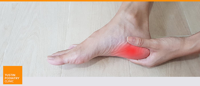 Plantar Fasciitis Treatment Specialist Near Me in Tustin, CA 