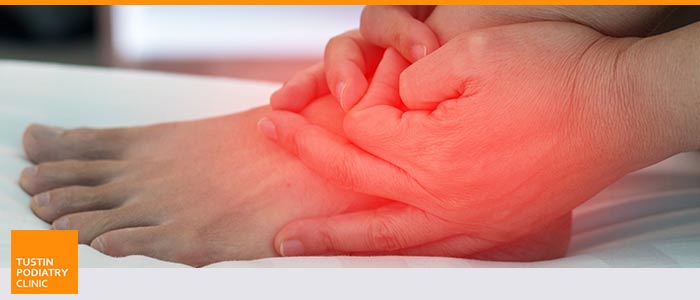 Foot Ganglion Cyst Treatment Specialist Near Me in Tustin CA Foot Ganglion Cyst Treatment Specialist Near Me in Tustin CA
